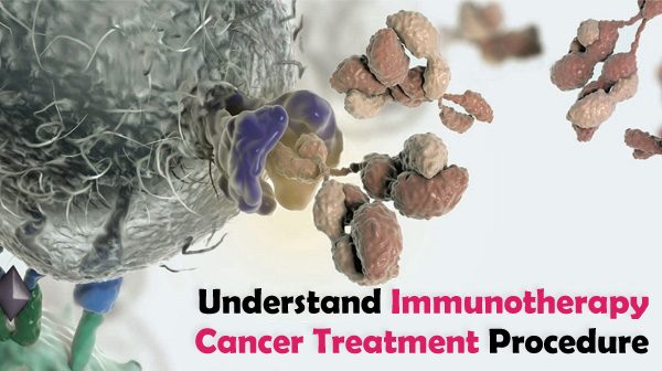 What is Immunotherapy and How Does it Works for Cancer