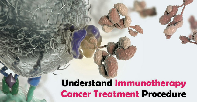 What is Immunotherapy and How Does it Works for Cancer