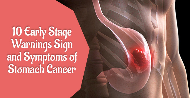 10 Early Stage warnings Sign and Symptoms of Stomach Cancer