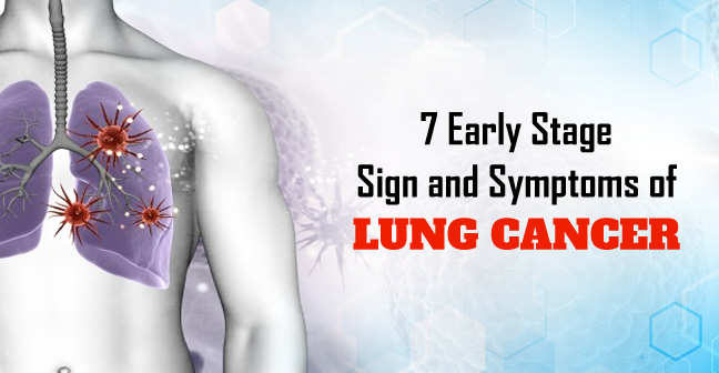 7 Early Stage Sign and Symptoms of Lung Cancer