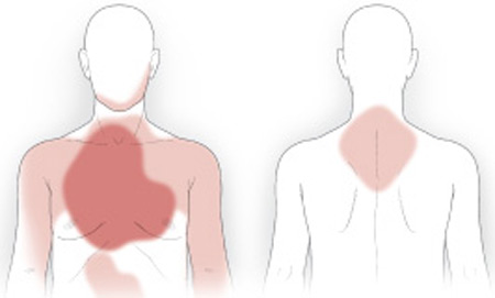 4th sign and symptoms of lung cancer - Persistent Chest and Back Pain