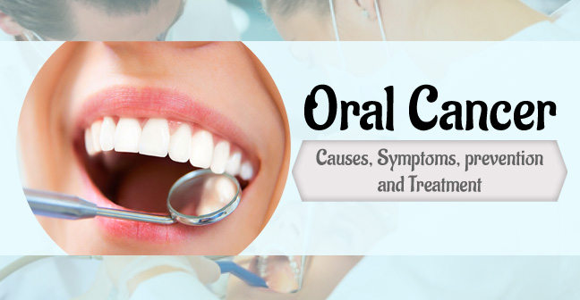 Signs and Symptoms of Oral Cancer