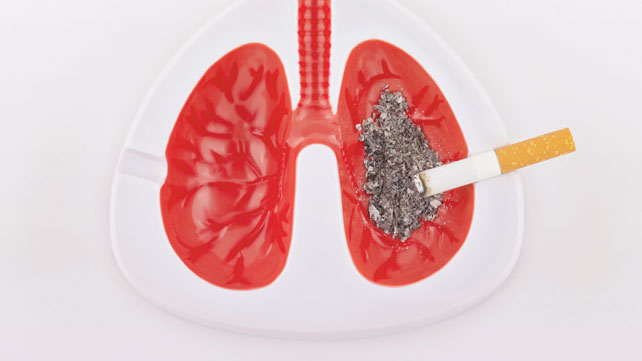 causes of lung cancer