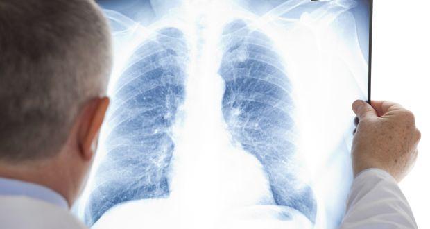 lung cancer diagnosis