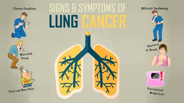 The Symptoms of Lung Cancer in Males and Females