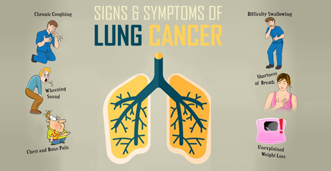 Lung Cancer Symptoms In Young Adults - CancerWalls