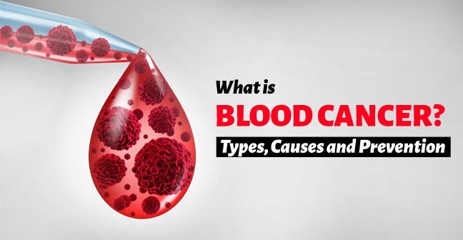 blood cancer types