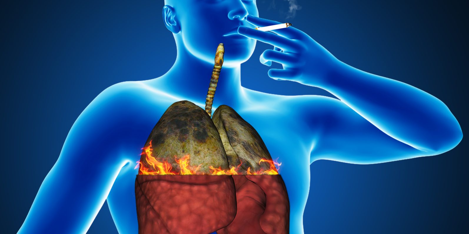 lung cancer symptoms in men