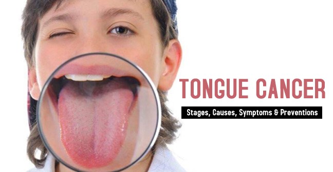 Cancer Spots On Tongue