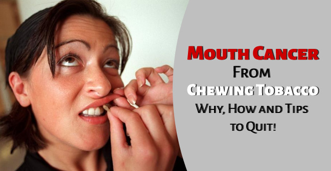 Mouth / Oral Cancer From Chewing Tobacco – Chances and Symptoms