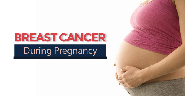 breast cancer during pregnancy