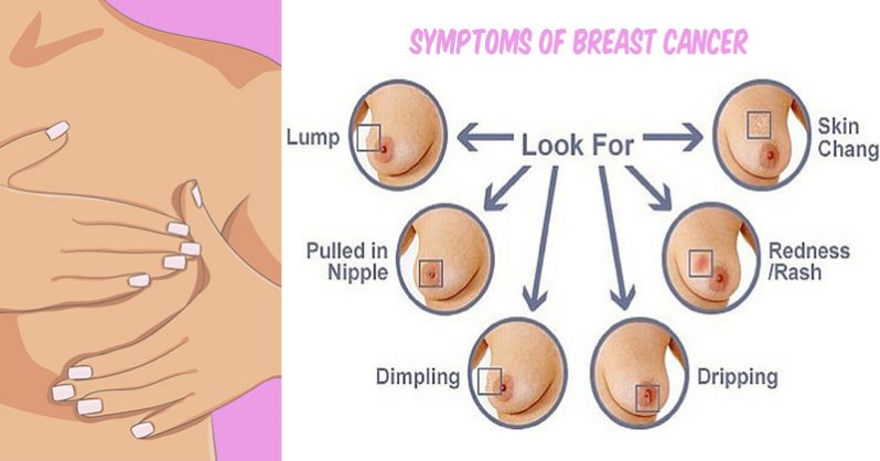 breast cancer self examination steps