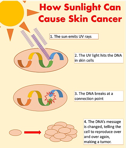 main causes of cancer