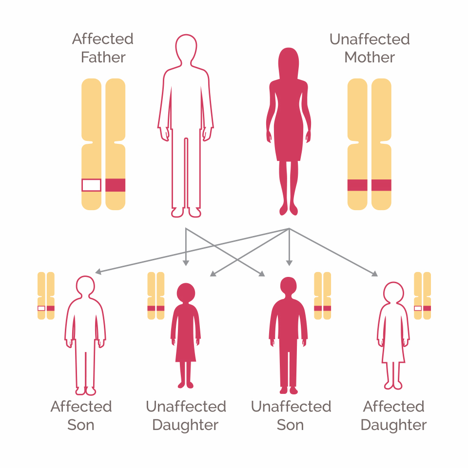 main causes of cancer