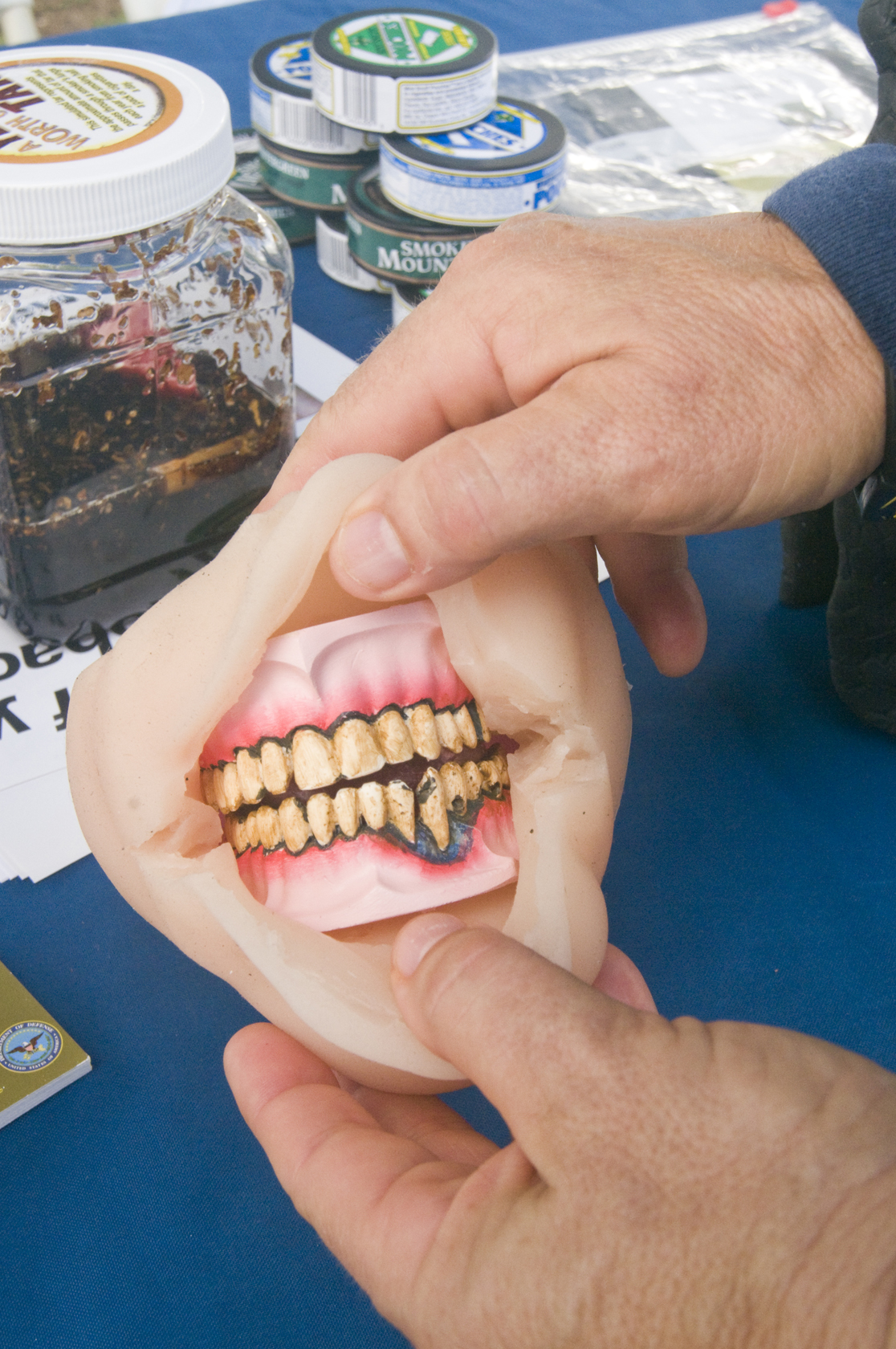 oral cancer from chewing tobacco
