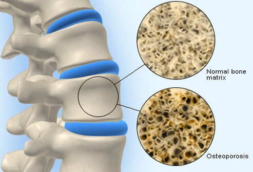 side effects of chemotherapy 3