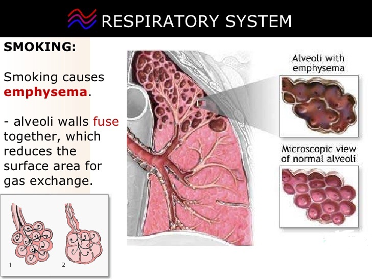 smoking is injurious to health and respiratory system