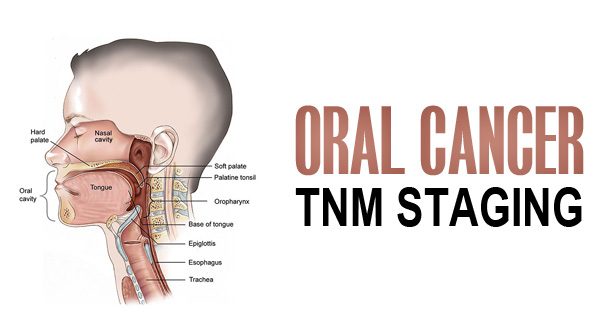 Oral Cancer TNM Staging and It’s Classification