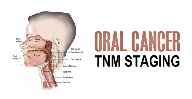 Oral Cancer TNM Staging and It’s Classification