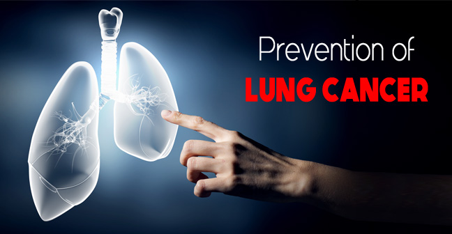 Prevention of Lung Cancer, Risk Factors and Precautions