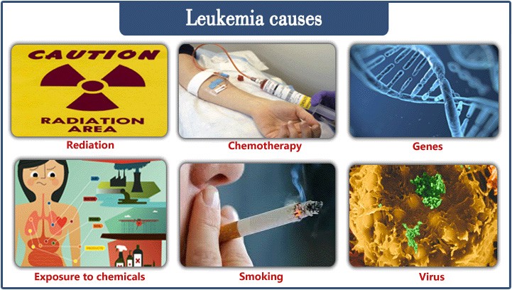 leukemia causes