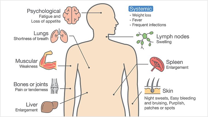 symptoms of leukemia