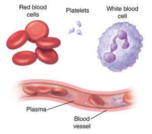 type of blood cancer