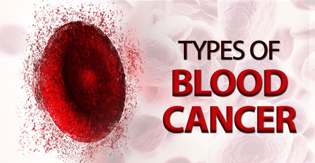 Types of Blood Cancer