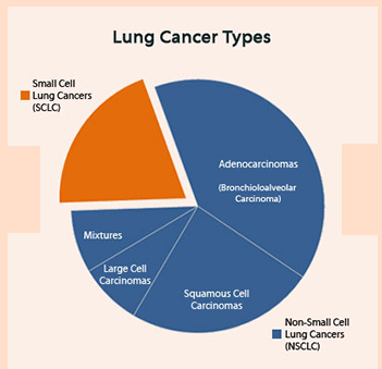 types of lung cancer