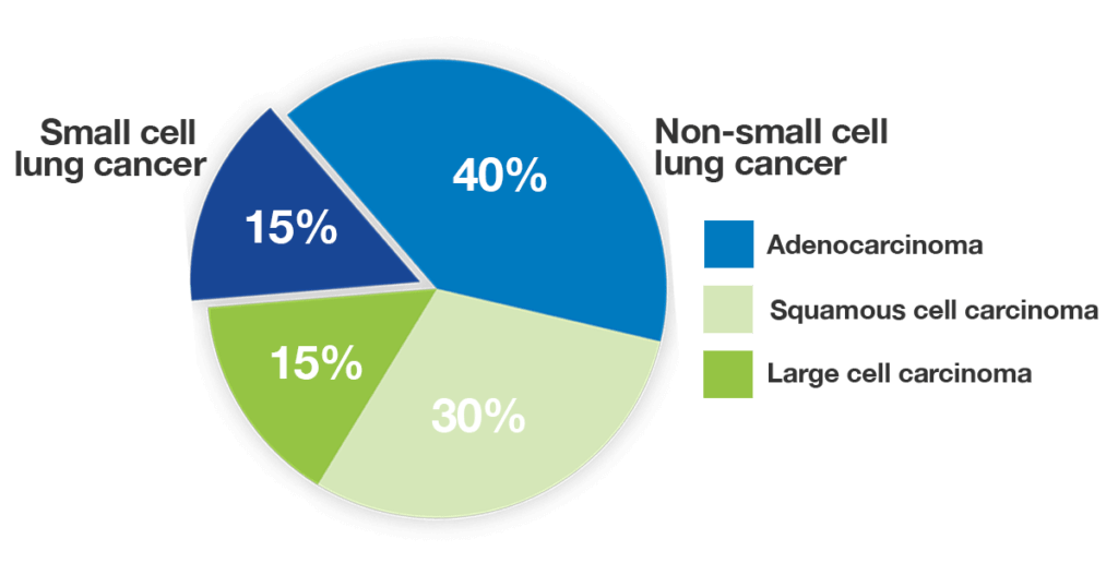 Lung cancer non small cell symptoms