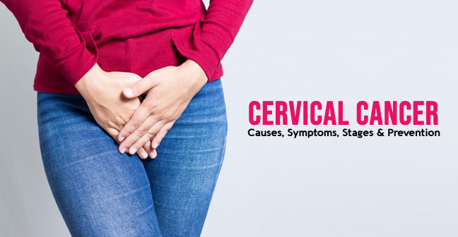 Cervical Cancer – Causes, Symptoms, Stages & Prevention