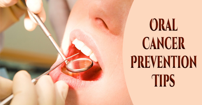 Oral / Mouth Cancer Prevention Tips