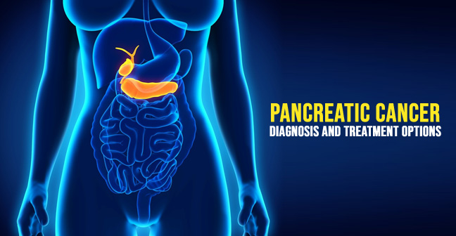 Pancreatic Cancer Diagnosis and Treatment Options