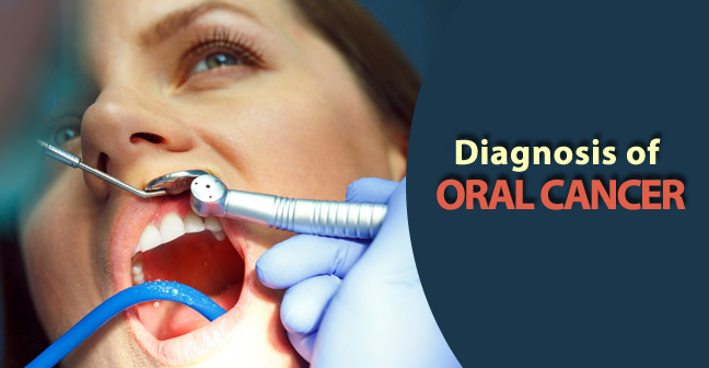 diagnosis of oral cancer