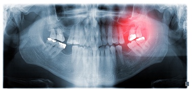 recent advances in diagnosis of oral cancer