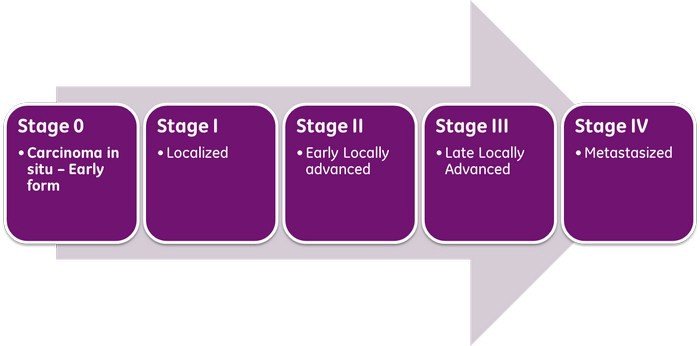 blood cancer stages