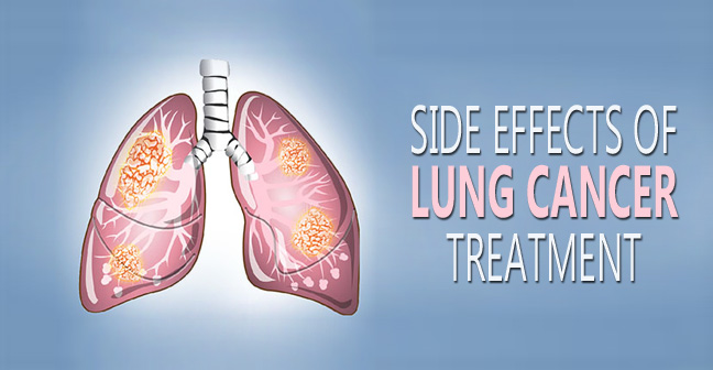 side effects of lung cancer treatment